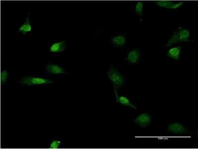 Immunocytochemistry/ Immunofluorescence: Lamin B1 Antibody (4E4) [H00004001-M03]