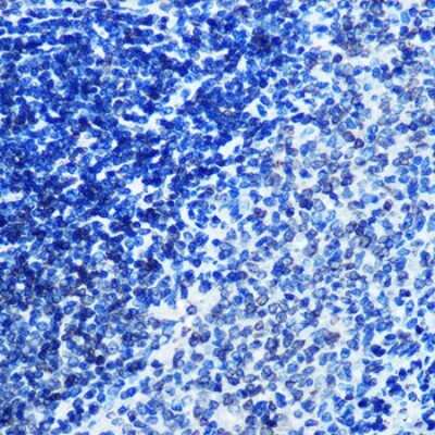 Immunohistochemistry-Paraffin: Lamin B1 Antibody (5H8V8) [NBP3-15393]