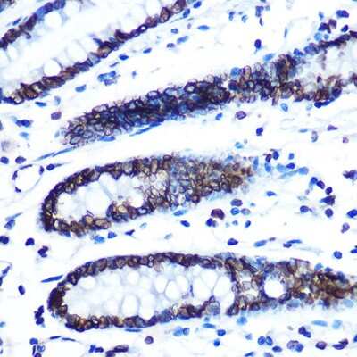 Immunohistochemistry-Paraffin: Lamin B1 Antibody (5H8V8) [NBP3-15393]