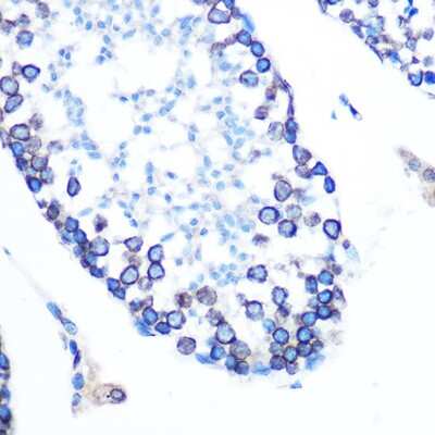 Immunohistochemistry-Paraffin: Lamin B1 Antibody (5H8V8) [NBP3-15393]