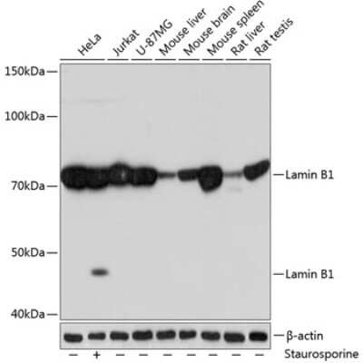 Western Blot: Lamin B1 Antibody (5H8V8) [NBP3-15393]