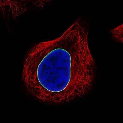 Immunocytochemistry/ Immunofluorescence: Lamin B1 Antibody (CL3929) [NBP2-59783]
