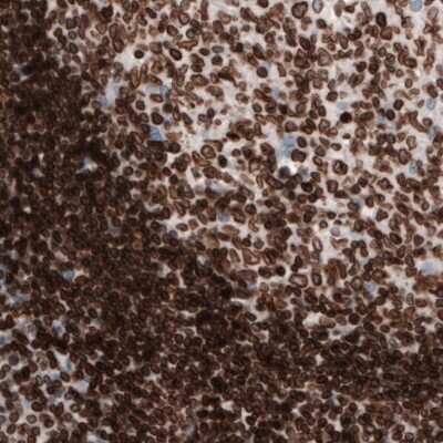 Immunohistochemistry-Paraffin: Lamin B1 Antibody (CL3929) [NBP2-59783]