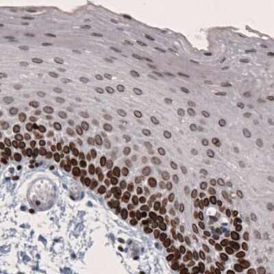 Immunohistochemistry-Paraffin: Lamin B1 Antibody (CL3929) [NBP2-59783]