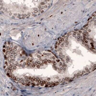 Immunohistochemistry-Paraffin: Lamin B1 Antibody (CL3929) [NBP2-59783]
