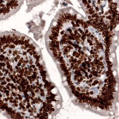 Immunohistochemistry-Paraffin: Lamin B1 Antibody (CL3929) [NBP2-59783]