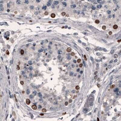 Immunohistochemistry-Paraffin: Lamin B1 Antibody (CL3929) [NBP2-59783]