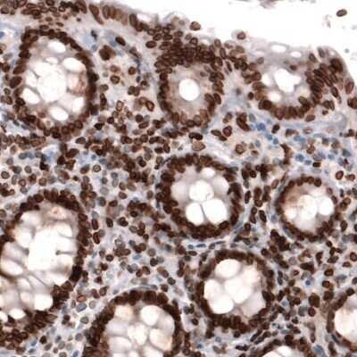 Immunohistochemistry-Paraffin: Lamin B1 Antibody (CL3929) [NBP2-59783]