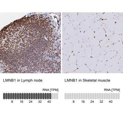 Immunohistochemistry-Paraffin: Lamin B1 Antibody [NBP2-48966]