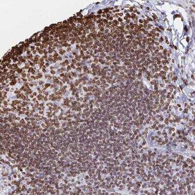 Immunohistochemistry-Paraffin: Lamin B1 Antibody [NBP2-48966]