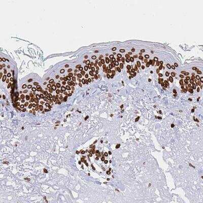 Immunohistochemistry-Paraffin: Lamin B1 Antibody [NBP2-48966]