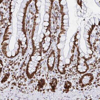 Immunohistochemistry-Paraffin: Lamin B1 Antibody [NBP2-48966]