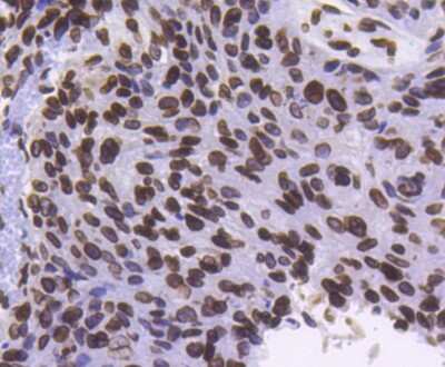 Immunohistochemistry-Paraffin: Lamin B1 Antibody (SI17-07) [NBP2-67405]