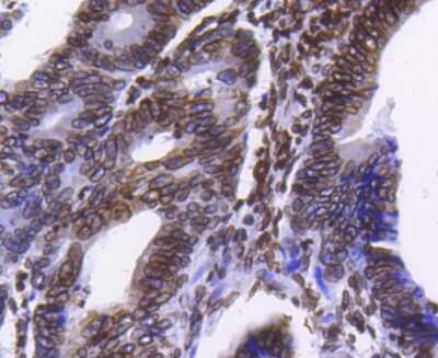Immunohistochemistry-Paraffin: Lamin B1 Antibody (SI17-07) [NBP2-67405]