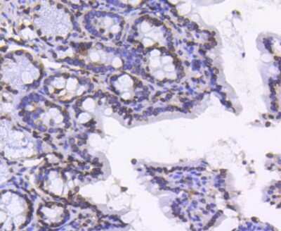 Immunohistochemistry-Paraffin: Lamin B1 Antibody (SI17-07) [NBP2-67405]