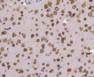 Immunohistochemistry-Paraffin: Lamin B1 Antibody (SI17-07) [NBP2-67405]