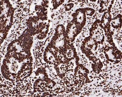 Immunohistochemistry-Paraffin: Lamin B1 Antibody (SI17-07) [NBP2-67405]