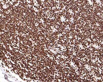 Immunohistochemistry-Paraffin: Lamin B1 Antibody (SI17-07) [NBP2-67405]
