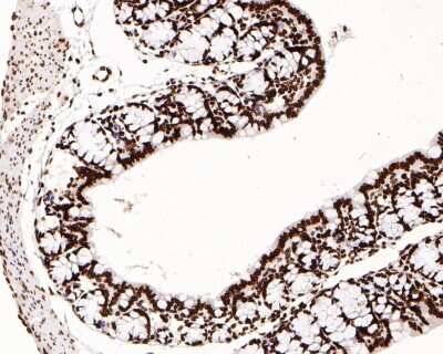 Immunohistochemistry-Paraffin: Lamin B1 Antibody (SI17-07) [NBP2-67405]