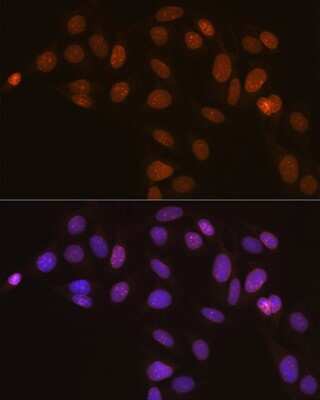 Immunocytochemistry/ Immunofluorescence: Lamin B2 Antibody (1S9M6) [NBP3-16527]