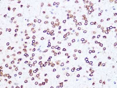 Immunohistochemistry-Paraffin: Lamin B2 Antibody (1S9M6) [NBP3-16527]