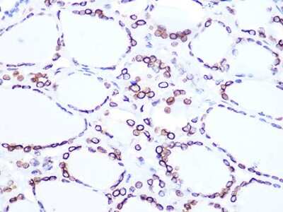 Immunohistochemistry-Paraffin: Lamin B2 Antibody (1S9M6) [NBP3-16527]