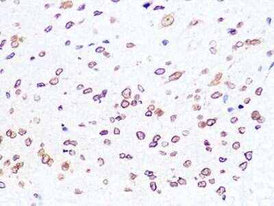 Immunohistochemistry-Paraffin: Lamin B2 Antibody (1S9M6) [NBP3-16527]