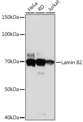 Western Blot: Lamin B2 Antibody (1S9M6) [NBP3-16527]