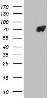 Western Blot: Lamin B2 Antibody (OTI2C6) [NBP2-45655]