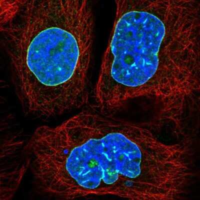 Immunocytochemistry/ Immunofluorescence: Lamin B2 Antibody [NBP2-49368]