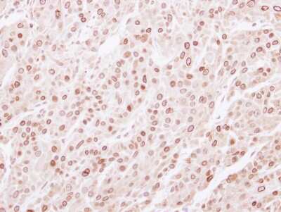 Immunohistochemistry-Paraffin: Lamin B2 Antibody [NBP2-19325]
