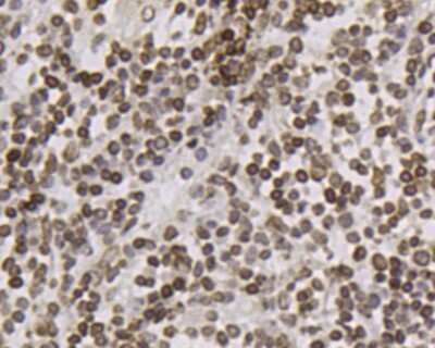 Immunohistochemistry-Paraffin: Lamin B2 Antibody (J9-C4) [NBP2-66923]