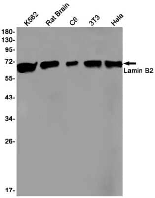 Western Blot: Lamin B2 Antibody (S02-9I7) [NBP3-15054]