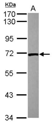 Western Blot: Lamin B2 Antibody [NBP2-19325]