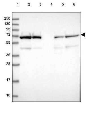 Western Blot: Lamin B2 Antibody [NBP2-48882]