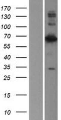 Western Blot: Lamin B2 Overexpression Lysate [NBP2-05979]