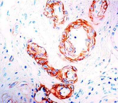 Immunohistochemistry-Paraffin: Laminin Antibody (4C7) [NB120-17107]