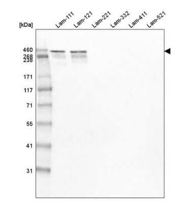 Western Blot: Laminin Antibody (CL2968) [NBP2-42384]