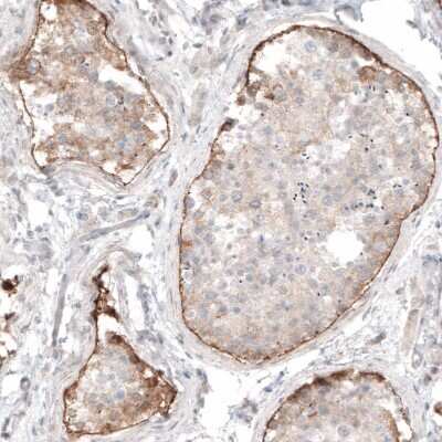 Immunohistochemistry-Paraffin: Laminin Antibody (CL3087) [NBP2-42389]
