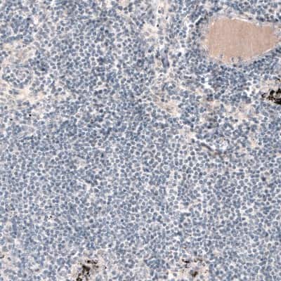 Immunohistochemistry-Paraffin: Laminin Antibody (CL3087) [NBP2-42389]
