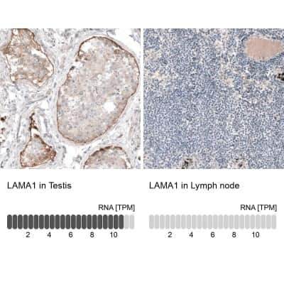 Immunohistochemistry-Paraffin: Laminin Antibody (CL3087) [NBP2-42389]