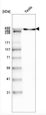 Western Blot: Laminin Antibody (CL3087) [NBP2-42389]