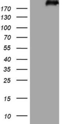 Western Blot: Laminin S/Laminin beta 2 Antibody (OTI3B4) [NBP2-45583]