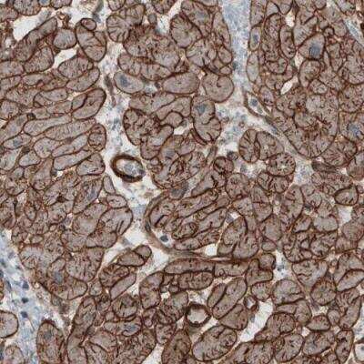 Immunohistochemistry-Paraffin: Laminin S/Laminin beta 2 Antibody (CL2976) [NBP2-42386]