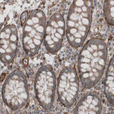 Immunohistochemistry-Paraffin: Laminin S/Laminin beta 2 Antibody (CL2976) [NBP2-42386]