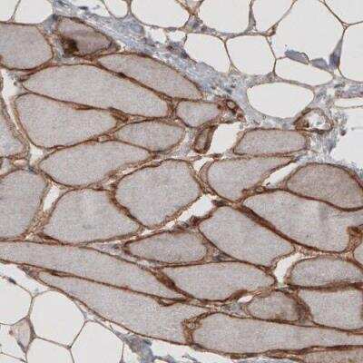Immunohistochemistry-Paraffin: Laminin S/Laminin beta 2 Antibody (CL2976) [NBP2-42386]