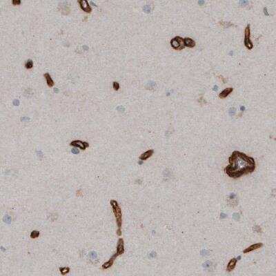 Immunohistochemistry-Paraffin: Laminin S/Laminin beta 2 Antibody (CL2976) [NBP2-42386]
