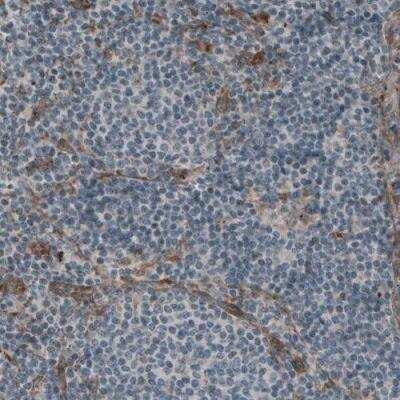 Immunohistochemistry-Paraffin: Laminin S/Laminin beta 2 Antibody (CL2976) [NBP2-42386]