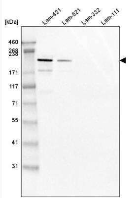 Western Blot: Laminin S/Laminin beta 2 Antibody (CL2976) [NBP2-42386]