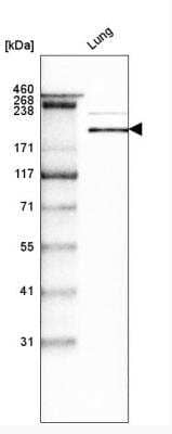 Western Blot: Laminin S/Laminin beta 2 Antibody (CL2976) [NBP2-42386]